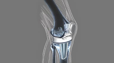 Prótesis articular