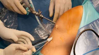 Reconstrucción de ligamentos